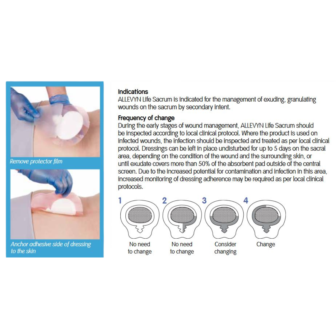 ALLEVYN Life Foam Sacrum Dressing – Anatomical silicone adhesive dressing for sacral wounds